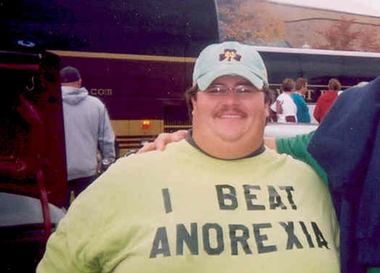  Vogue Italia против анорексии